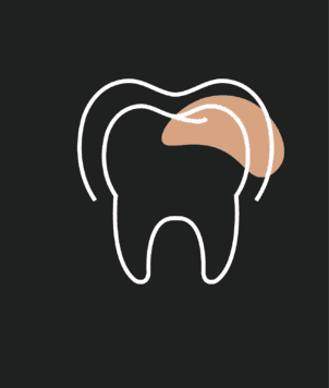 İnvisalign (Şeffaf Plak)